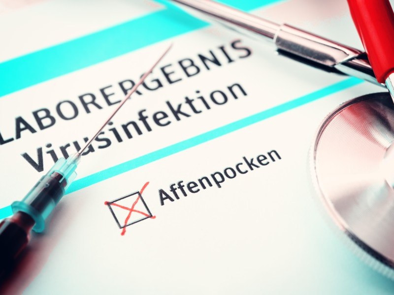 Affenpocken in Niedersachsen